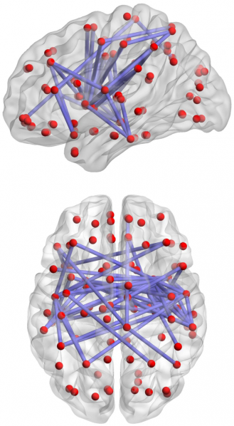 File:Brain network.png