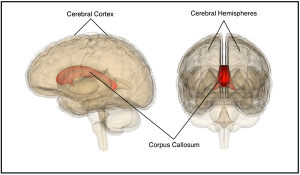 Callosumhemispheres600.png